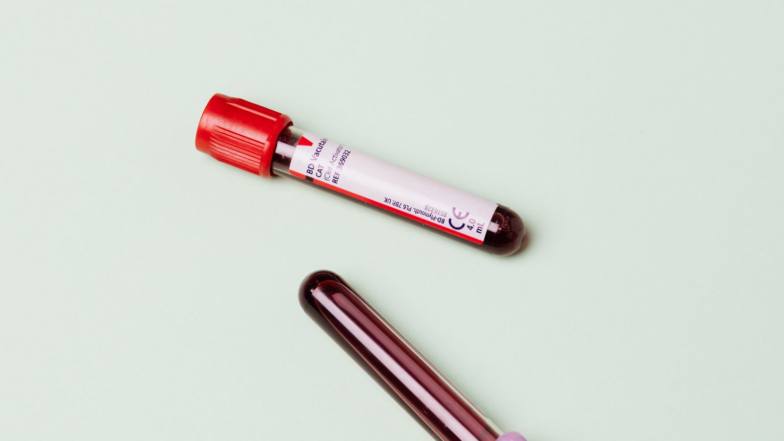 Hormone Tests in IVF: FSH, LH, E2, and More