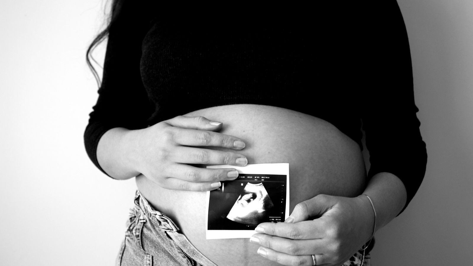 Ectopic Pregnancy: Symptoms, Diagnosis, and Treatment